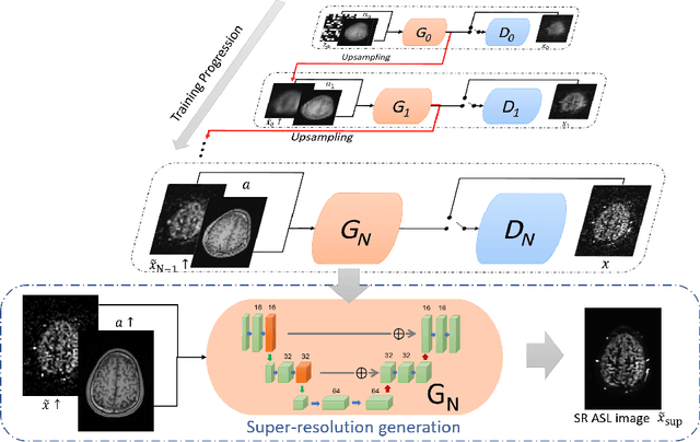 Figure 1 for Super Resolution of Arterial Spin Labeling MR Imaging Using Unsupervised Multi-Scale Generative Adversarial Network