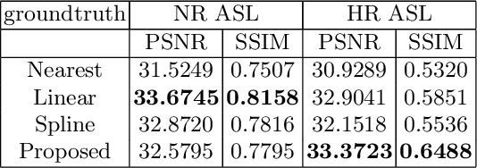 Figure 2 for Super Resolution of Arterial Spin Labeling MR Imaging Using Unsupervised Multi-Scale Generative Adversarial Network