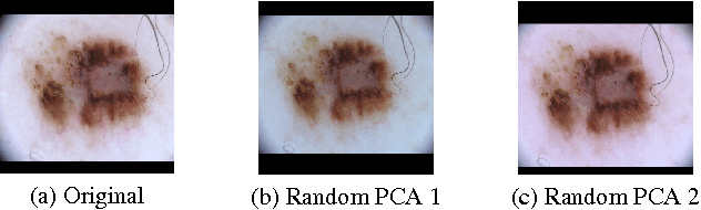 Figure 1 for Convolutional Neural Network Committees for Melanoma Classification with Classical And Expert Knowledge Based Image Transforms Data Augmentation