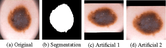 Figure 3 for Convolutional Neural Network Committees for Melanoma Classification with Classical And Expert Knowledge Based Image Transforms Data Augmentation