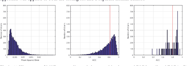 Figure 2 for Deep Learning Captures More Accurate Diffusion Fiber Orientations Distributions than Constrained Spherical Deconvolution