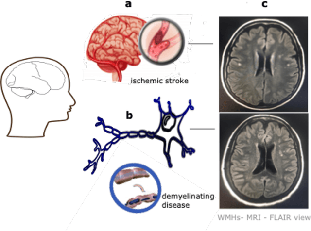 Figure 1 for MRI Images, Brain Lesions and Deep Learning