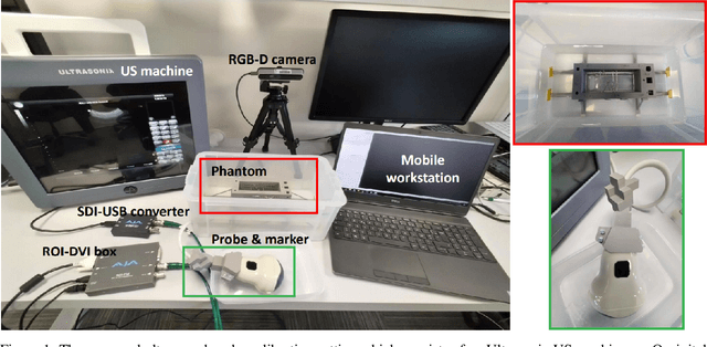 Figure 1 for A Novel Augmented Reality Ultrasound Framework Using an RGB-D Camera and a 3D-printed Marker