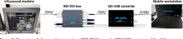 Figure 3 for A Novel Augmented Reality Ultrasound Framework Using an RGB-D Camera and a 3D-printed Marker