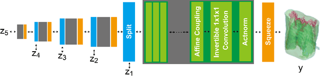 Figure 3 for X2CT-FLOW: Reconstruction of multiple volumetric chest computed tomography images with different likelihoods from a uni- or biplanar chest X-ray image using a flow-based generative model