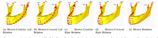 Figure 4 for Relational Reasoning Network (RRN) for Anatomical Landmarking