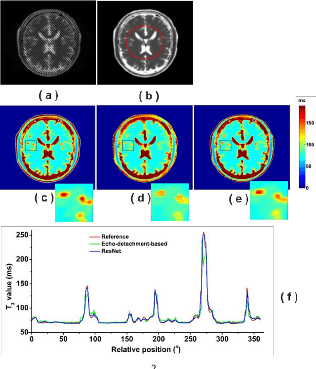Figure 3 for High Efficient Reconstruction of Single-shot T2 Mapping from OverLapping-Echo Detachment Planar Imaging Based on Deep Residual Network