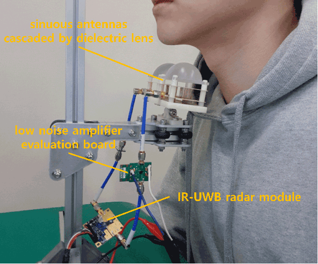 Figure 1 for Movement Detection of Tongue and Related Body Parts Using IR-UWB Radar