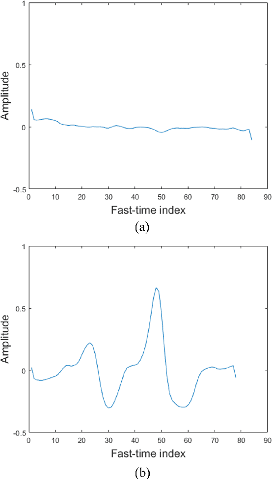 Figure 3 for Movement Detection of Tongue and Related Body Parts Using IR-UWB Radar