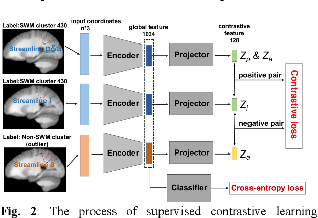 Figure 3 for SupWMA: Consistent and Efficient Tractography Parcellation of Superficial White Matter with Deep Learning