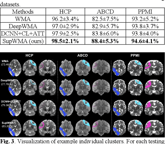 Figure 4 for SupWMA: Consistent and Efficient Tractography Parcellation of Superficial White Matter with Deep Learning