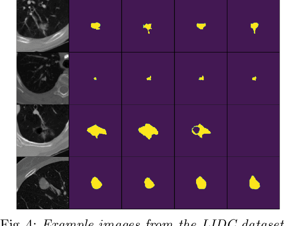 Figure 4 for Improving Aleatoric Uncertainty Quantification in Multi-Annotated Medical ImageSegmentation with Normalizing Flows