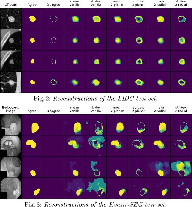 Figure 3 for Improving Aleatoric Uncertainty Quantification in Multi-Annotated Medical Image Segmentation with Normalizing Flows