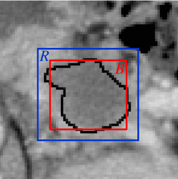 Figure 2 for A Novel and Efficient Tumor Detection Framework for Pancreatic Cancer via CT Images