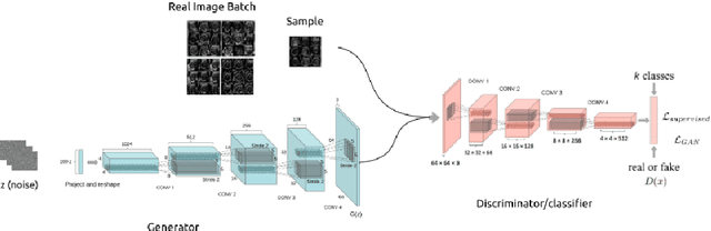 Figure 1 for Empirical Study of Quality Image Assessment for Synthesis of Fetal Head Ultrasound Imaging with DCGANs