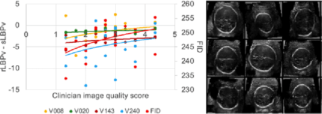 Figure 2 for Empirical Study of Quality Image Assessment for Synthesis of Fetal Head Ultrasound Imaging with DCGANs