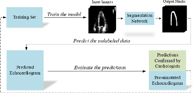 Figure 4 for Early Detection of Myocardial Infarction in Low-Quality Echocardiography