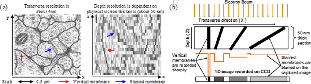 Figure 1 for Super-resolution using Sparse Representations over Learned Dictionaries: Reconstruction of Brain Structure using Electron Microscopy