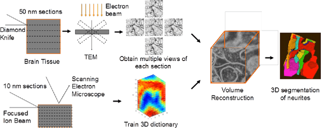 Figure 2 for Super-resolution using Sparse Representations over Learned Dictionaries: Reconstruction of Brain Structure using Electron Microscopy