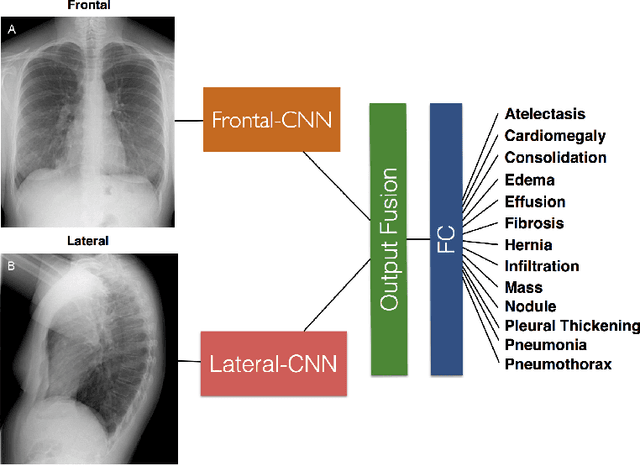 Figure 1 for Large Scale Automated Reading of Frontal and Lateral Chest X-Rays using Dual Convolutional Neural Networks
