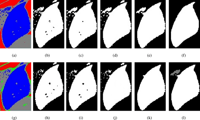 Figure 3 for Automatic CT Segmentation from Bounding Box Annotations using Convolutional Neural Networks