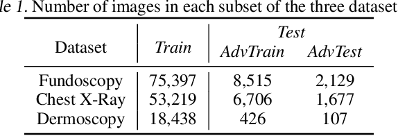 Figure 2 for Understanding Adversarial Attacks on Deep Learning Based Medical Image Analysis Systems