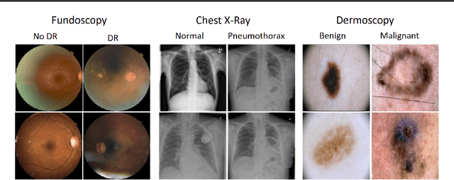 Figure 3 for Understanding Adversarial Attacks on Deep Learning Based Medical Image Analysis Systems