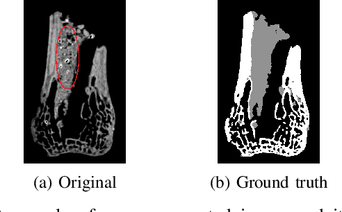 Figure 1 for Multi-Class Micro-CT Image Segmentation Using Sparse Regularized Deep Networks