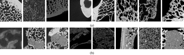 Figure 2 for Multi-Class Micro-CT Image Segmentation Using Sparse Regularized Deep Networks