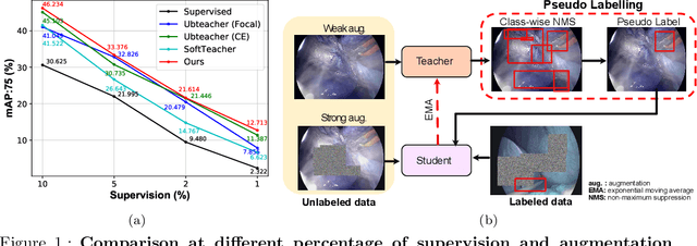 Figure 1 for A semi-supervised Teacher-Student framework for surgical tool detection and localization