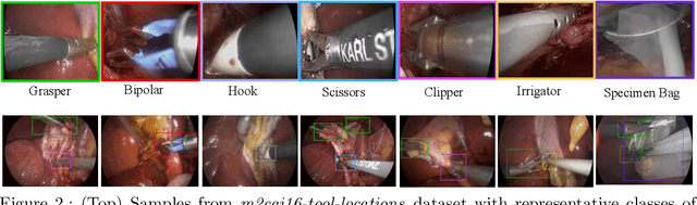 Figure 3 for A semi-supervised Teacher-Student framework for surgical tool detection and localization