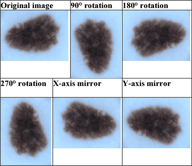 Figure 1 for The Effects of Image Pre- and Post-Processing, Wavelet Decomposition, and Local Binary Patterns on U-Nets for Skin Lesion Segmentation