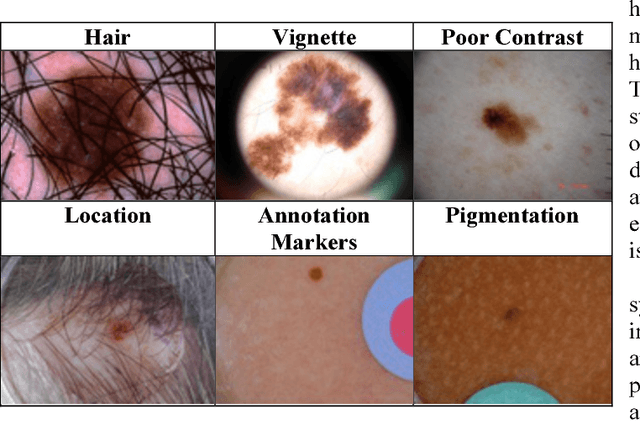 Figure 3 for The Effects of Image Pre- and Post-Processing, Wavelet Decomposition, and Local Binary Patterns on U-Nets for Skin Lesion Segmentation