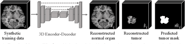 Figure 2 for Self-supervised Tumor Segmentation through Layer Decomposition