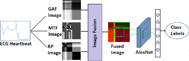 Figure 1 for ECG Heart-beat Classification Using Multimodal Image Fusion