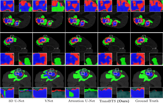 Figure 3 for TransBTS: Multimodal Brain Tumor Segmentation Using Transformer