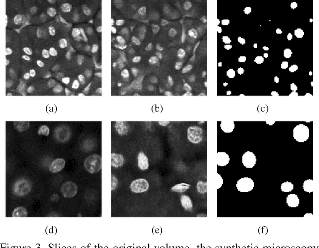 Figure 4 for Three Dimensional Fluorescence Microscopy Image Synthesis and Segmentation