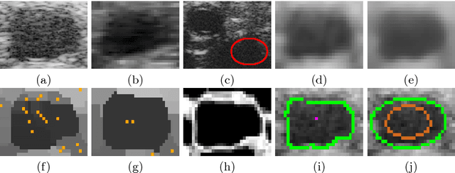 Figure 1 for Fast Vessel Segmentation and Tracking in Ultra High-Frequency Ultrasound Images