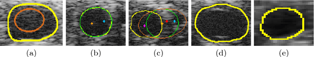 Figure 2 for Fast Vessel Segmentation and Tracking in Ultra High-Frequency Ultrasound Images
