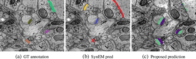 Figure 4 for Detecting Synapse Location and Connectivity by Signed Proximity Estimation and Pruning with Deep Nets