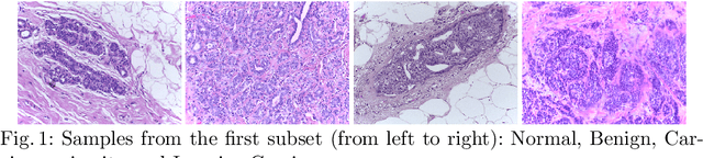 Figure 1 for Ensembling Neural Networks for Digital Pathology Images Classification and Segmentation