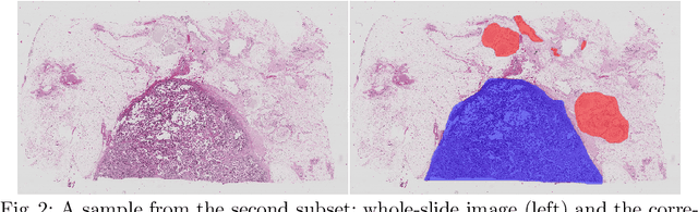 Figure 3 for Ensembling Neural Networks for Digital Pathology Images Classification and Segmentation