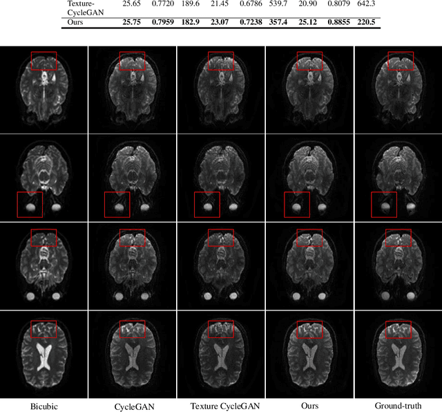 Figure 4 for Multi-Texture GAN: Exploring the Multi-Scale Texture Translation for Brain MR Images