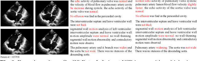 Figure 3 for Factored Attention and Embedding for Unstructured-view Topic-related Ultrasound Report Generation