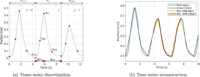 Figure 1 for Modeling biomedical breathing signals with convolutional deep probabilistic autoencoders