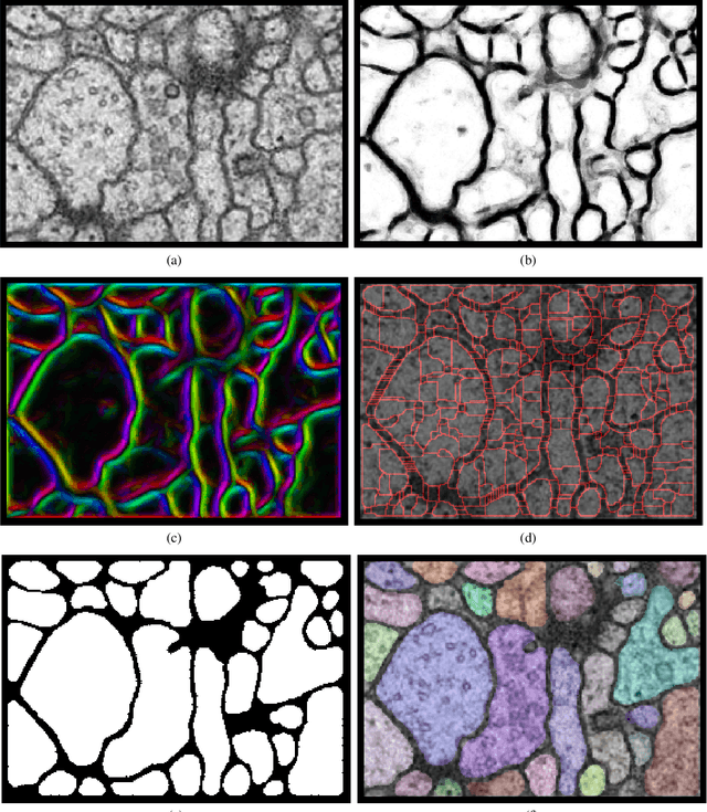 Figure 1 for Efficient 2D neuron boundary segmentation with local topological constraints