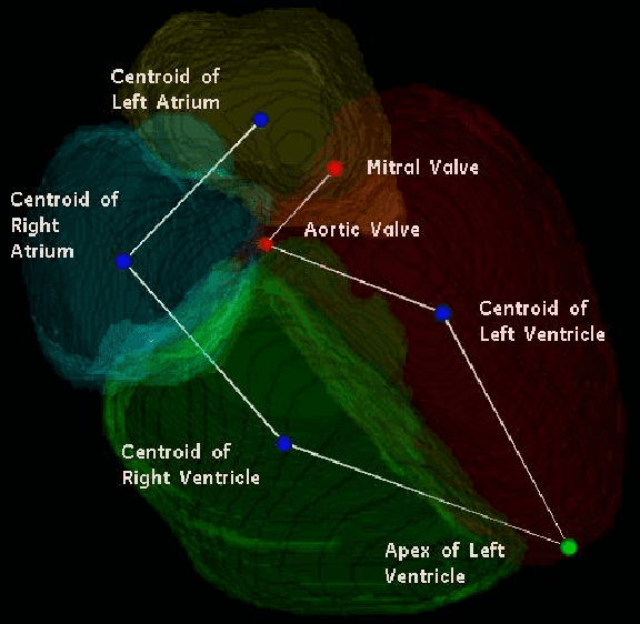 Figure 1 for An SVM Based Approach for Cardiac View Planning