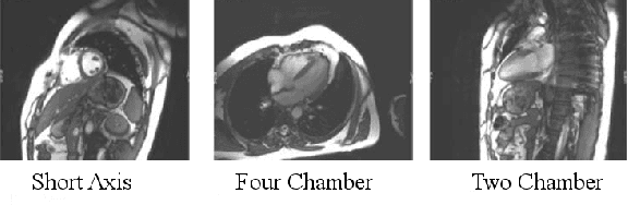 Figure 3 for An SVM Based Approach for Cardiac View Planning