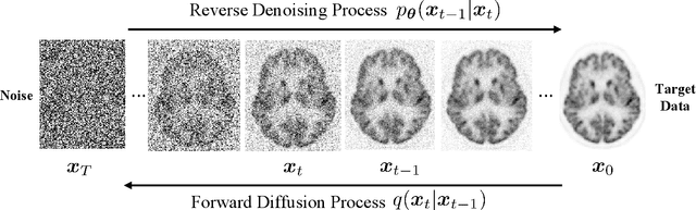 Figure 1 for PET image denoising based on denoising diffusion probabilistic models