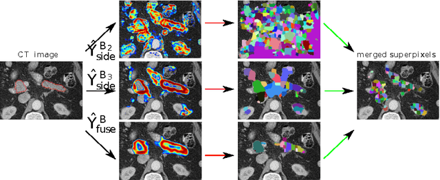 Figure 3 for Spatial Aggregation of Holistically-Nested Networks for Automated Pancreas Segmentation